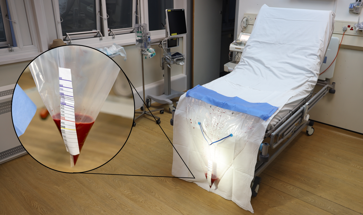 drape Close-up of a calibrated blood-collection drape, its calibrations printed in millilitres running from 100 to 1500, with collected blood visible at the 500 millilitre mark.