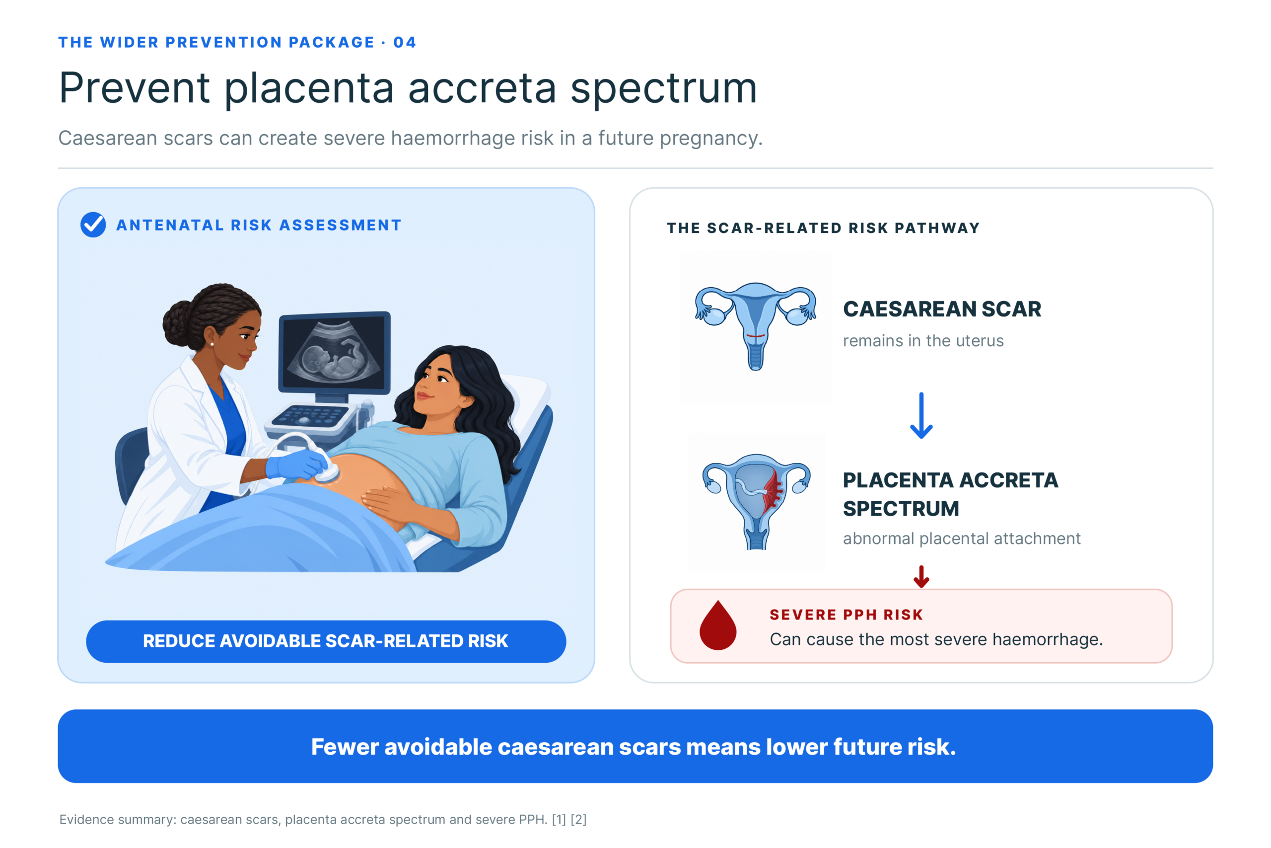 Preventing placenta accreta spectrum