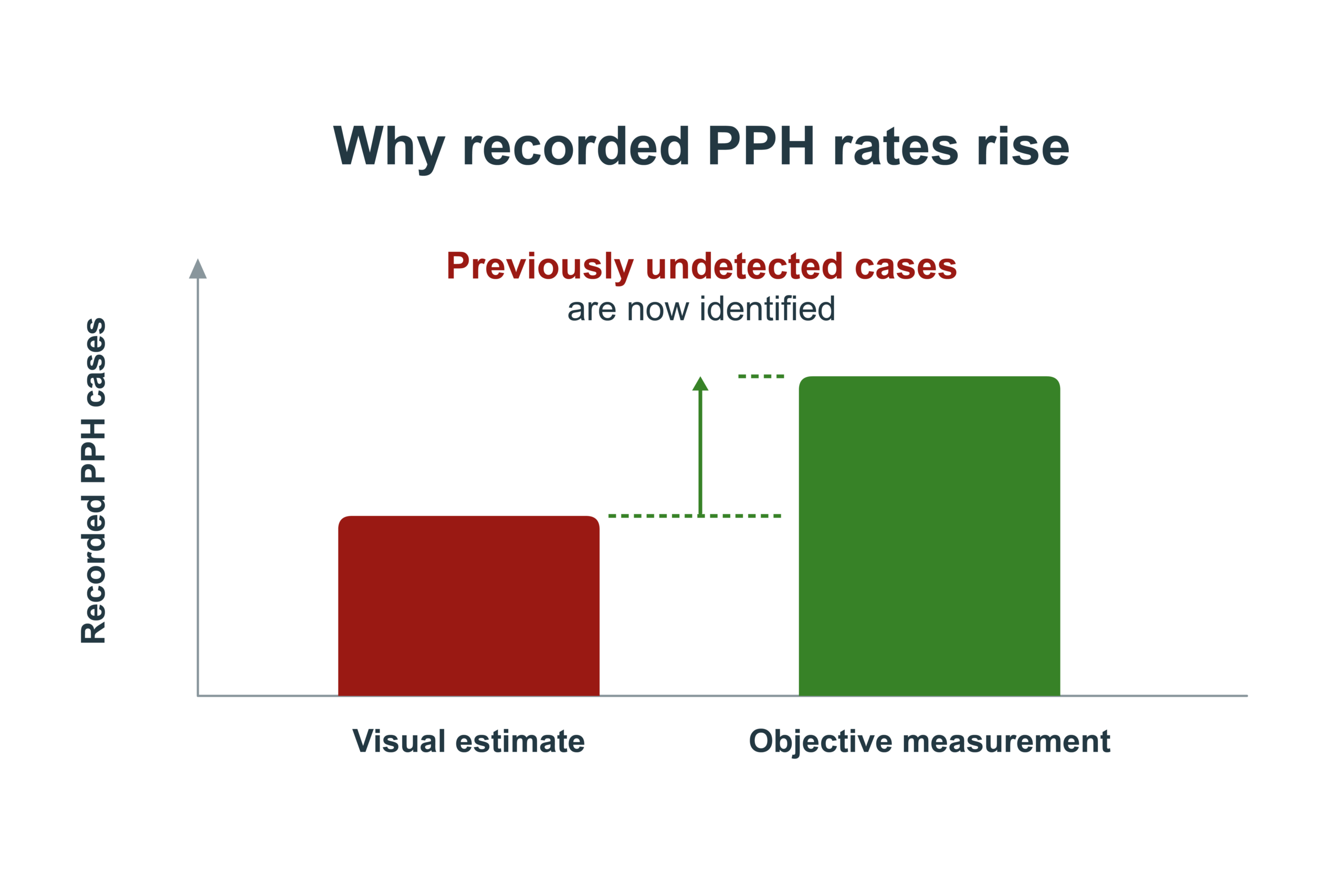 Conceptual bar chart: recorded PPH cases rise when blood loss is measured objectively rather than estimated visually, because previously undetected cases are now identified. The rise means better detection, not deteriorating care.