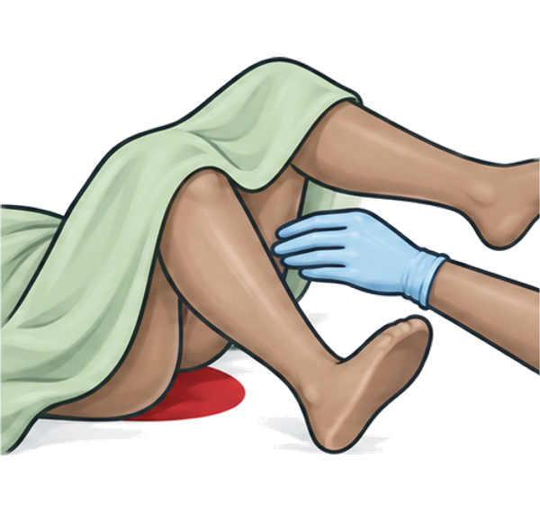 examination Examination of the genital tract